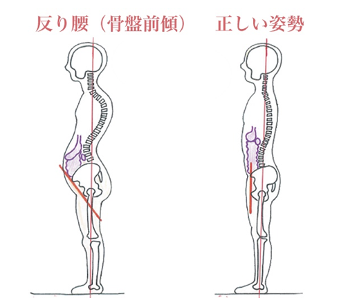 反り腰は太りやすい 自力で治すには チベット体操 ヨガでシンプルライフ